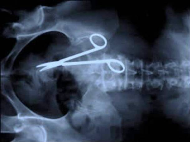 x-ray1
